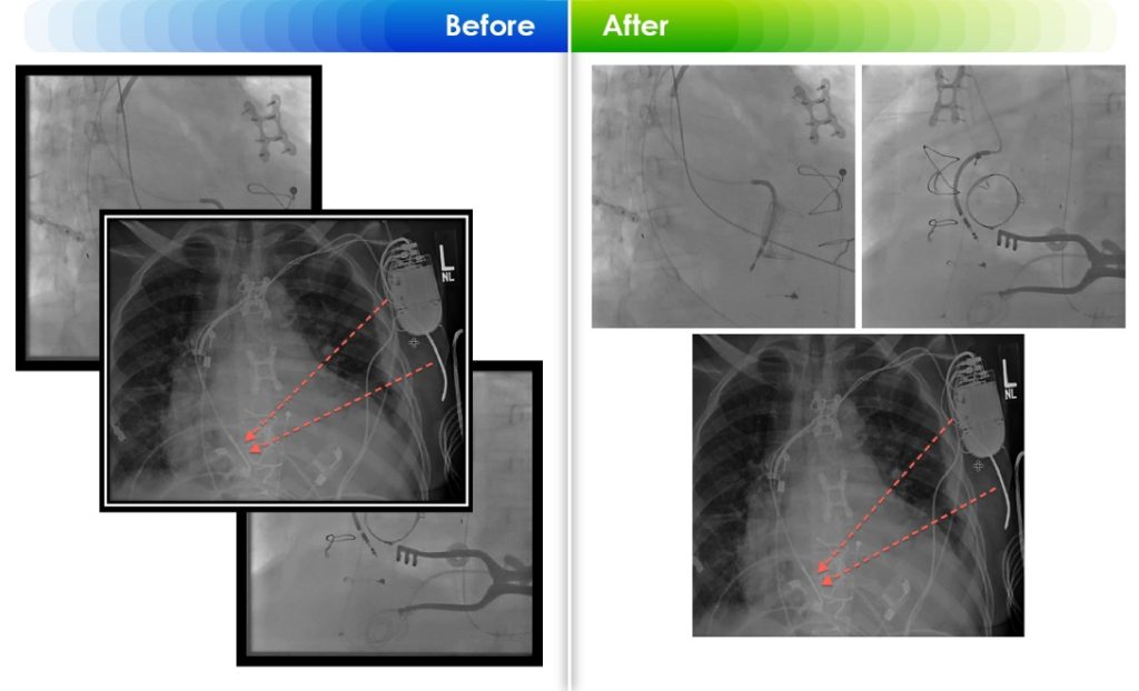 Manage Inpainting process to crop distracting parts and reconstruct lost elements