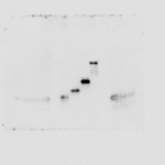 Unprocessed original image of western blot