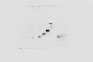 Unprocessed original image of western blot